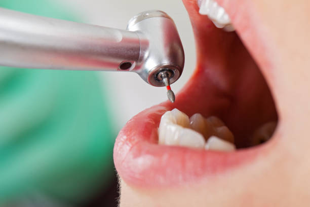 Best Pediatric Emergency Dentist in Lionville, PA